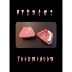 Fuji Prep Endodontik Çene Wax